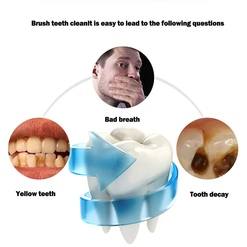 Escova de Dentes Elétrica Automática 360° em Formato U com Luz de Clareamento Fria