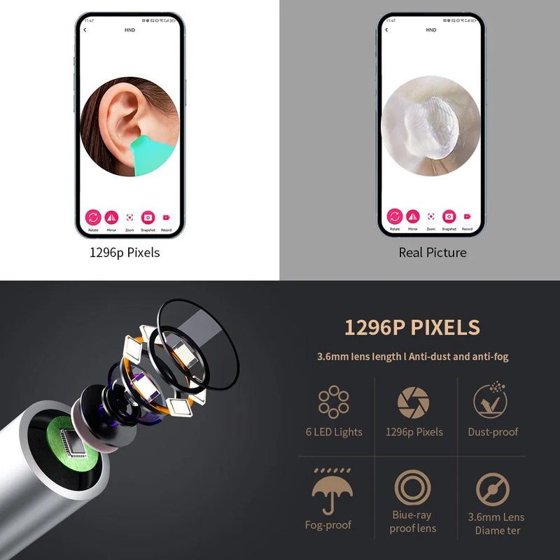 Limpador visual inteligente de ouvido com câmera 1296p e Conexão Wi-Fi
